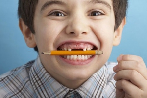 Nha khoa Nam Định giới thiệu chữa sâu răng cho trẻ em cực kỳ hiệu quả