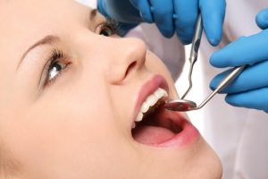 Có nên tẩy trắng răng hay không và áp dụng khi nào?